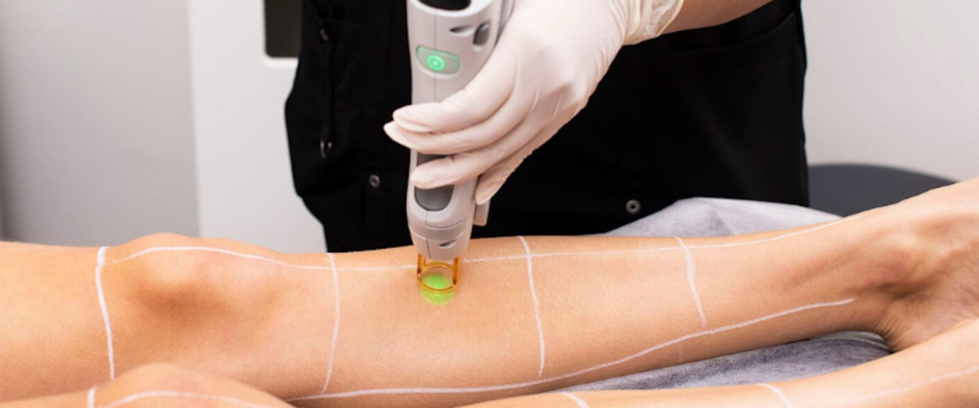 The Cost of Laser Hair Removal: A Comprehensive Guide