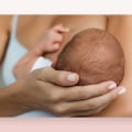 Laser Hair Removal for Pregnant and Breastfeeding Women: Is It Safe?