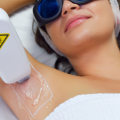 Say Goodbye to Stubble Woes with Laser Hair Removal
