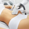 Is Laser Hair Removal Painful? An Expert's Guide to Comfort