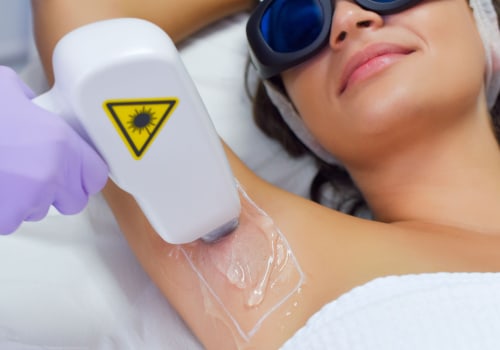 Say Goodbye to Stubble Woes with Laser Hair Removal
