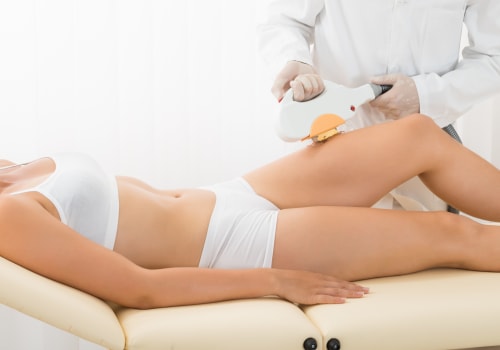 How Long Does Laser Hair Removal Last?