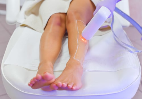 What is the Best Laser for Hair Removal?