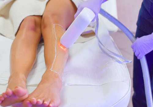 Everything You Need to Know About Laser Hair Removal: A Comprehensive Guide